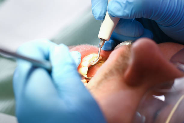 Best Tooth Pain Emergency Relief  in Brewster, OH