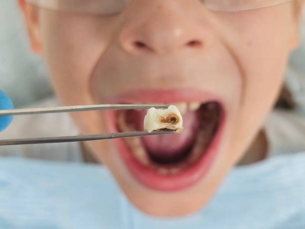 Emergency Dentist Open Today in OH