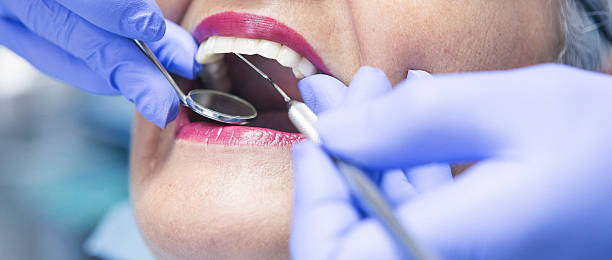 Best Teeth Whitening  in Brewster, OH